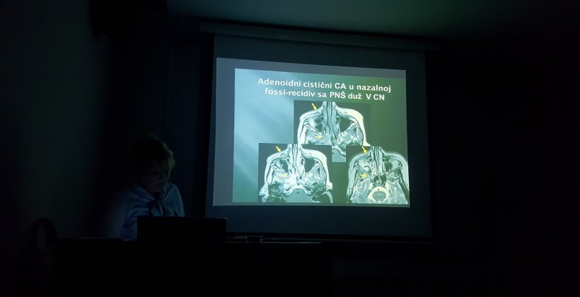 ODRŽAN JEDNODNEVNI SEMINAR – “Savremeni neuroradiološki imidžing”